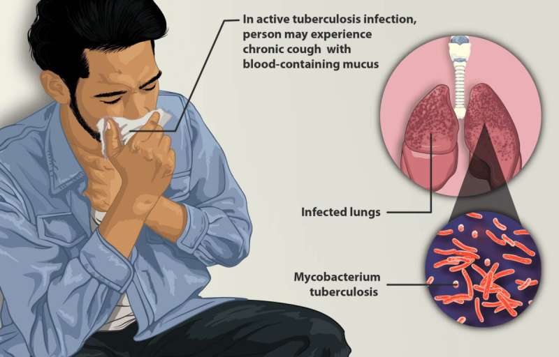 Active tuberculosis cases are currently higher in Harris County than anywhere else in Texas or the US.