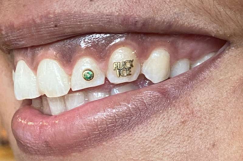A "FUCK ICE" tooth gem sits on a front tooth in someone's mouth.